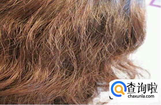 头皮油发尾干是什么发质