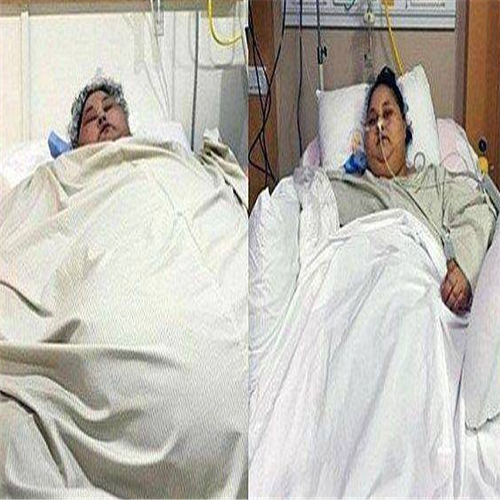 世界最胖的女人