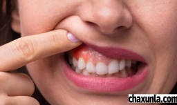牙口不好需要注意什么