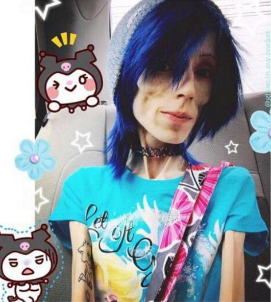 世界上最瘦的人