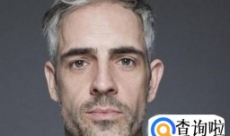 少白头的原因和对策有哪些？