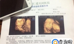 四维彩超的宝宝图片和生下宝宝的相貌有何区别